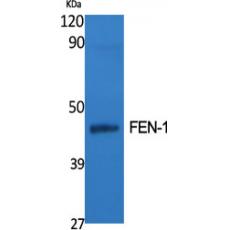 Anti-FEN-1 antibody