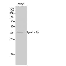 Anti-Ephrin-B3 antibody