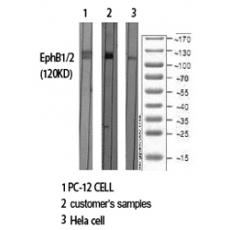 Anti-EphB1/2 antibody