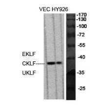 Anti-EKLF/CKLF/UKLF antibody