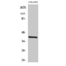 Anti-eIF3ε antibody