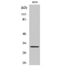 Anti-IL-5 antibody