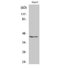 Anti-KVβ.3 antibody