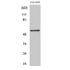 Anti-GPR176 antibody