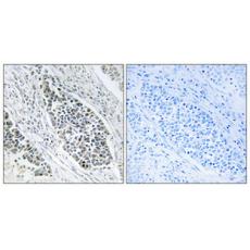 Anti-KDEL Receptor 2 antibody