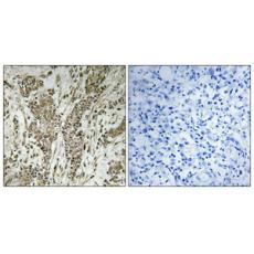 Anti-MAGI-2 antibody