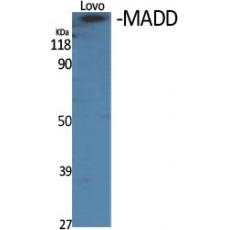 Anti-MADD antibody