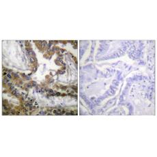 Anti-Flk-1/Flt-4 antibody