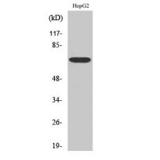 Anti-Follistatin antibody