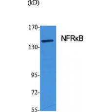 Anti-NFRκB antibody