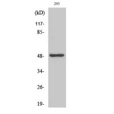 Anti-Neuro D2 antibody