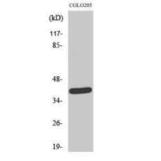 Anti-NEGR1 antibody