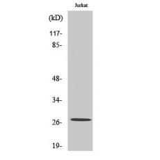Anti-NDUFV2 antibody