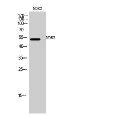 Anti-NDR2 antibody