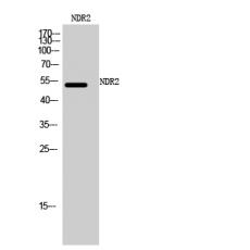 Anti-NDR2 antibody