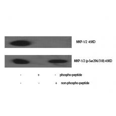 Anti-MKP-1/2 antibody