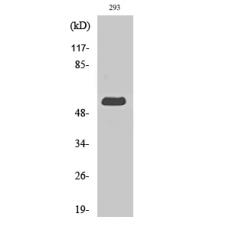 Anti-MIPP antibody