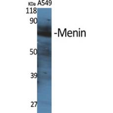 Anti-Menin antibody
