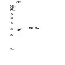 Anti-MMTAG2 antibody