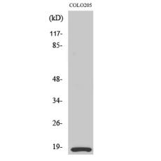 Anti-MRLC2 antibody