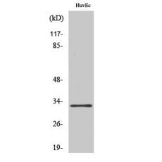 Anti-MRP-L24 antibody