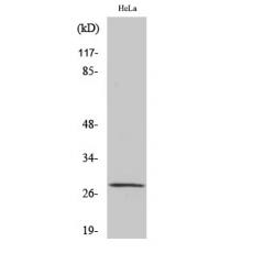 Anti-MRRF antibody