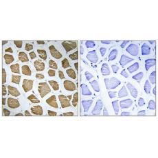 Anti-MRP-S22 antibody