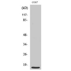 Anti-MRP-S21 antibody