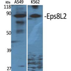 Anti-Eps8L2 antibody