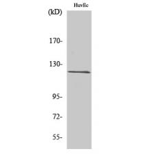 Anti-FIR antibody