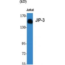 Anti-JIP-3 antibody