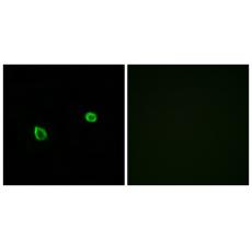 Anti-ERN2 antibody