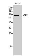 Anti-MALT1 antibody