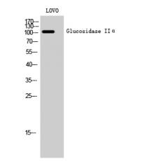 Anti-Glucosidase IIα antibody