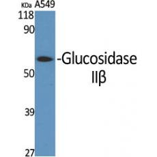 Anti-Glucosidase IIβ antibody