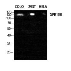 Anti-GPR158 antibody