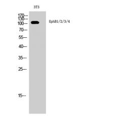 Anti-EphB1/2/3/4 antibody