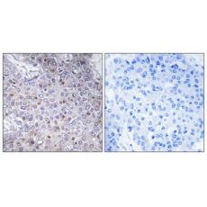 Anti-ELL antibody