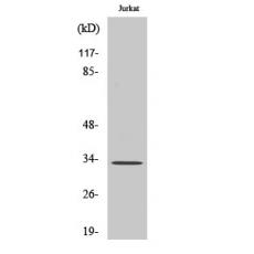 Anti-ELOVL1 antibody