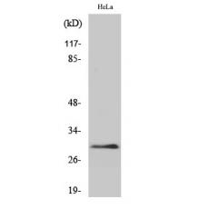 Anti-eIF3K antibody