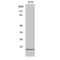 Anti-eIF5A2 antibody