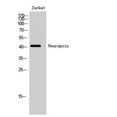 Anti-Neuropsin antibody