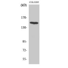 Anti-MINK1 antibody