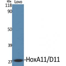 Anti-HoxA11/D11 antibody