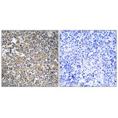 Anti-MAST205 antibody