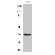 Anti-MC2-R antibody