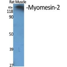 Anti-Myomesin-2 antibody
