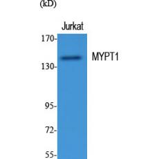 Anti-MYPT1 antibody