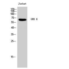 Anti-GRK 6 antibody