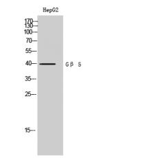 Anti-Gβ 5 antibody
